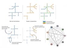 Cancer networks and nodes. (Graphic courtesy Zainab Arshad)